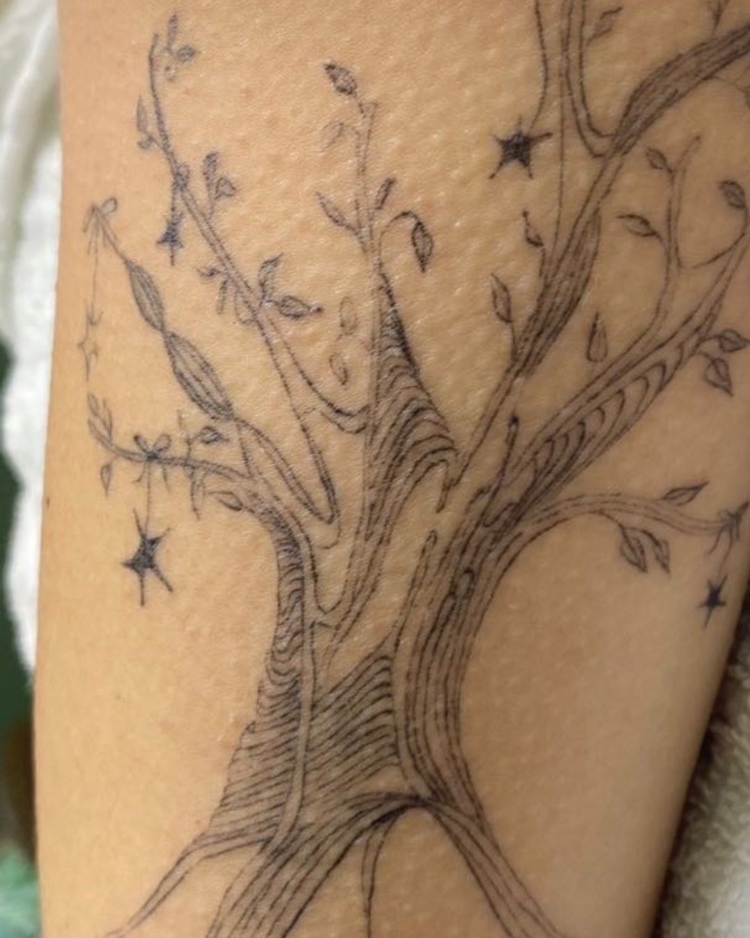 Tattoo before laser removal